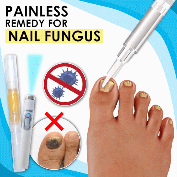 Anti-fungal Laser Home Treatment Set