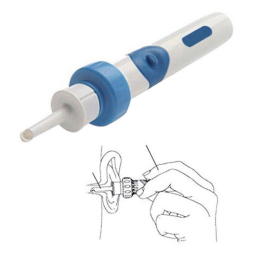 WaxOff - Ear Wax Removal Vacuum Cleaner