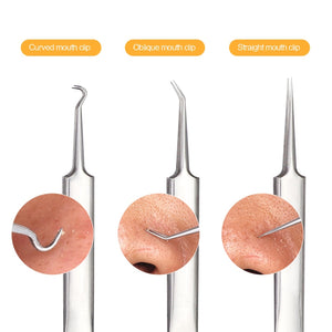 Blackhead Acne Remover Tool