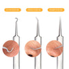 Blackhead Acne Remover Tool