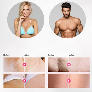FreshSkin - IPL Laser Hair Removal Handset