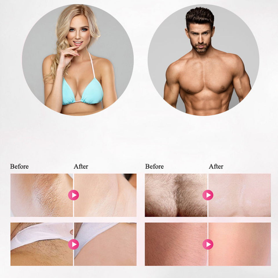 FreshSkin - IPL Laser Hair Removal Handset