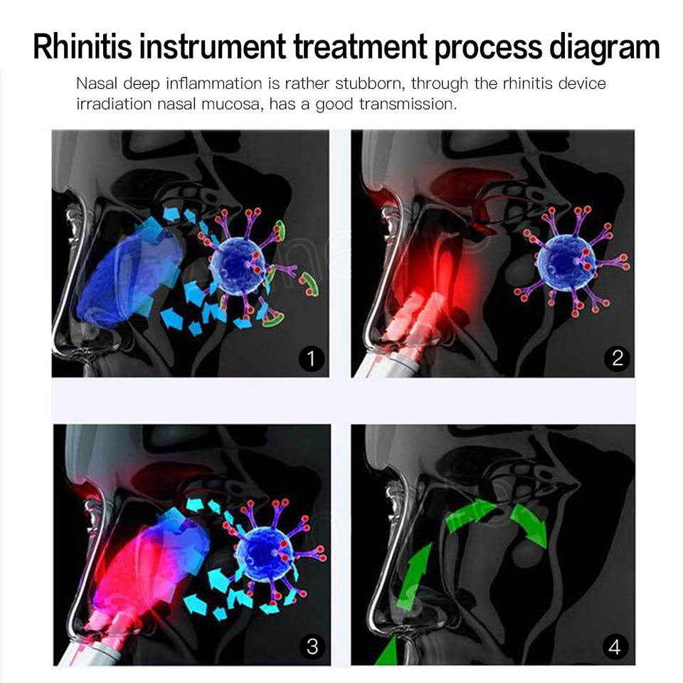 Rhinitis/Sinusitis Nose Therapy Massage Device