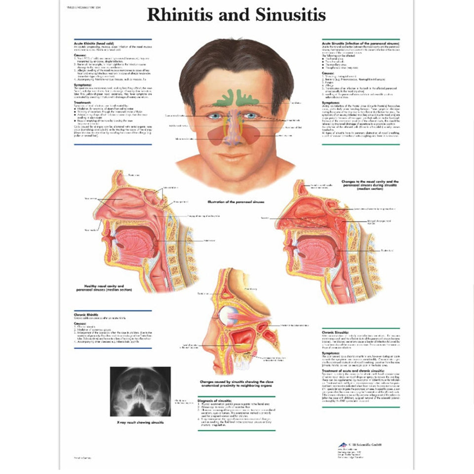 Rhinitis/Sinusitis Nose Therapy Massage Device