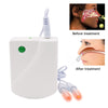 Rhinitis/Sinusitis Nose Therapy Massage Device