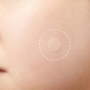 Skin Tag Remover Patch