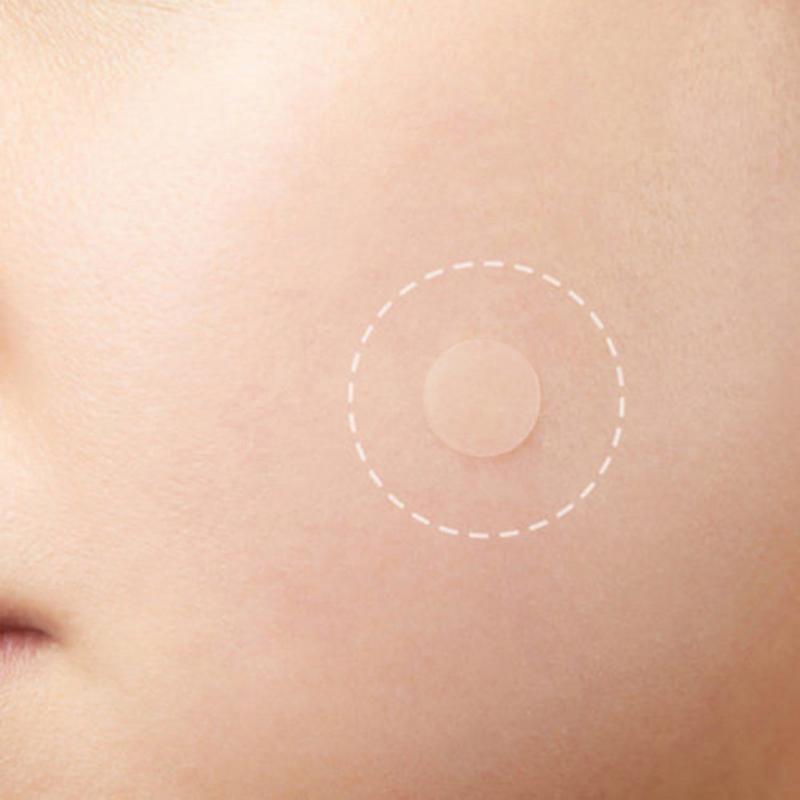 Skin Tag Remover Patch