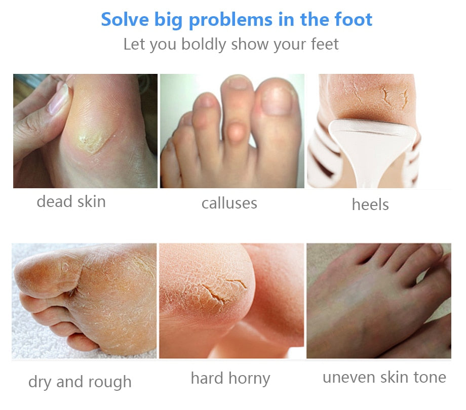 BabySkin - Ultimate Foot Peeling Mask