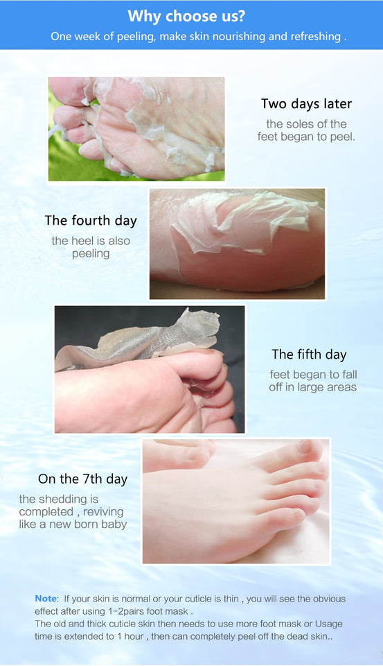 BabySkin - Ultimate Foot Peeling Mask