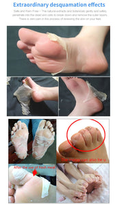 BabySkin - Ultimate Foot Peeling Mask