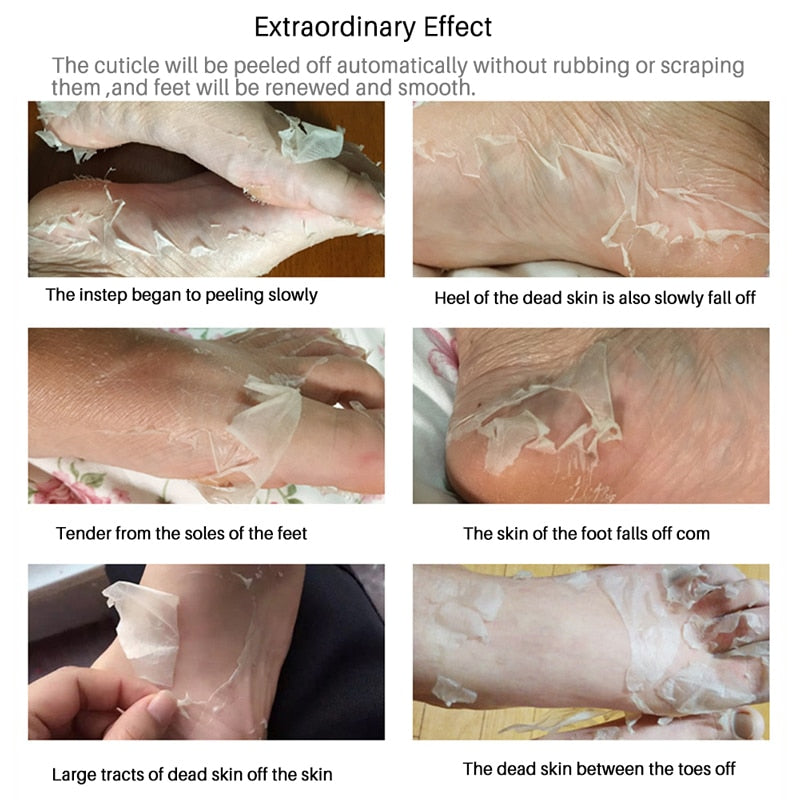BabySkin - Ultimate Foot Peeling Mask