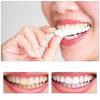 SmileNow - Magic Teeth Brace