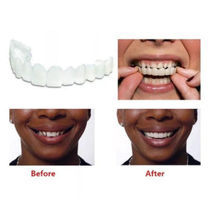 SmileNow - Magic Teeth Brace