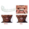 SmileNow - Magic Teeth Brace