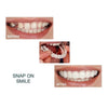 SmileNow - Magic Teeth Brace