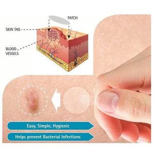 Skin Tag Remover Patch